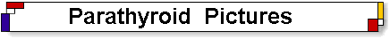parathyroid pictures and photos of hyperparathyrodiism, parathyroid gland pictures, parathyroid adenomas.