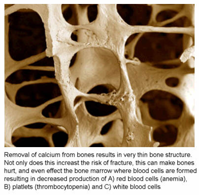 What are the effects of a bone marrow density scan?