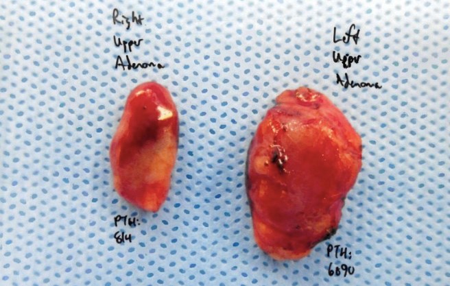 Interesting case of the week: The importance of looking at all four glands with Dr. Luke Watkins 2