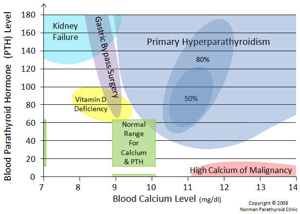 How To Diagnose Hyperparathyroidism For Patients And Doctors