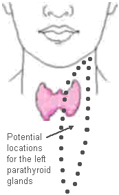 Locations of the left parathyroid gland--anywhere in the neck.