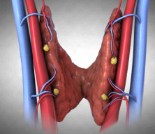 Parathyroid Animation is Award Winning... And COOL!