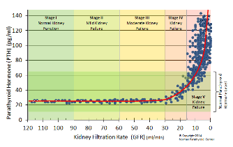 Secondary Hyperparathyroidism causes and diagnosis. Low vitamin D.