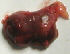 parathyroid adenoma picture