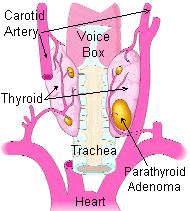Las cuatro glándulas paratiroides se muestran en esta imagen de color mostaza amarillo detrás de la glándula tiroidea  en color rosa.